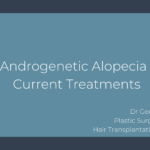 Androgenetic alopecia/ Current treatments