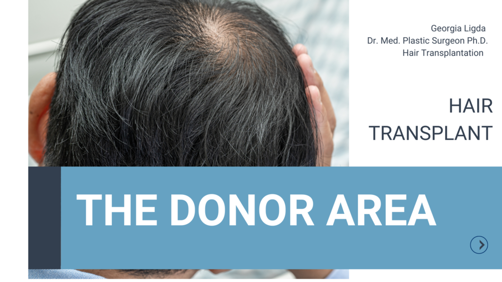 Hair Transplant: The donor area
