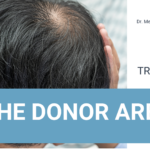 Hair Transplant: The donor area
