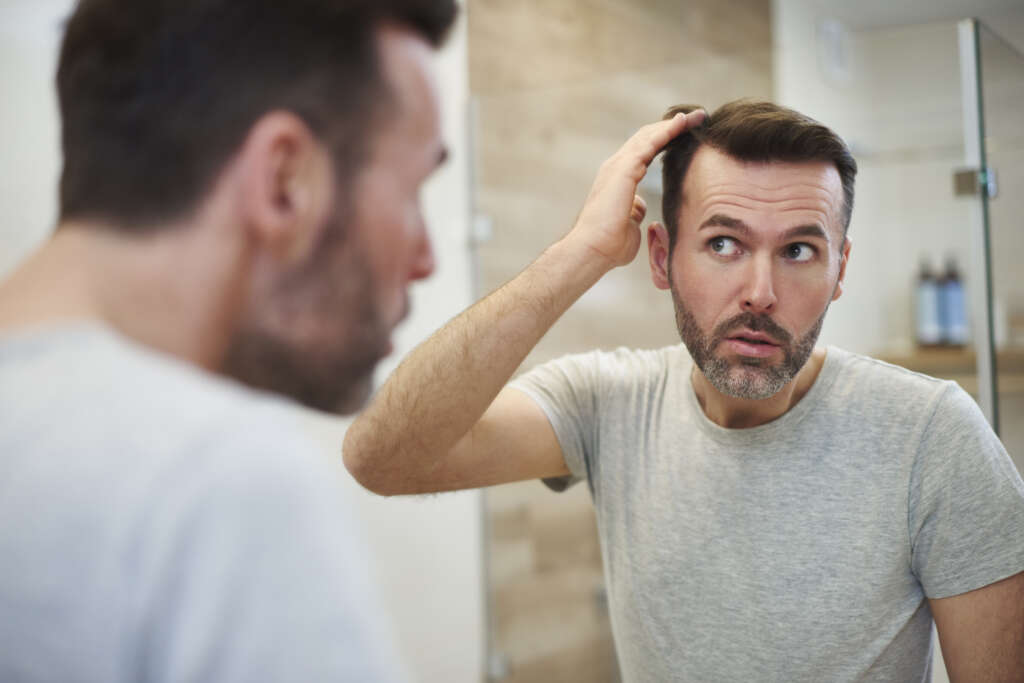 There is no need to shave the whole head for a hair transplant with the FUE/implanters method, but only the occipital part (donor area) of it. This ‘navy shave’ as it is called, is the scalp shave of choice for two reasons: